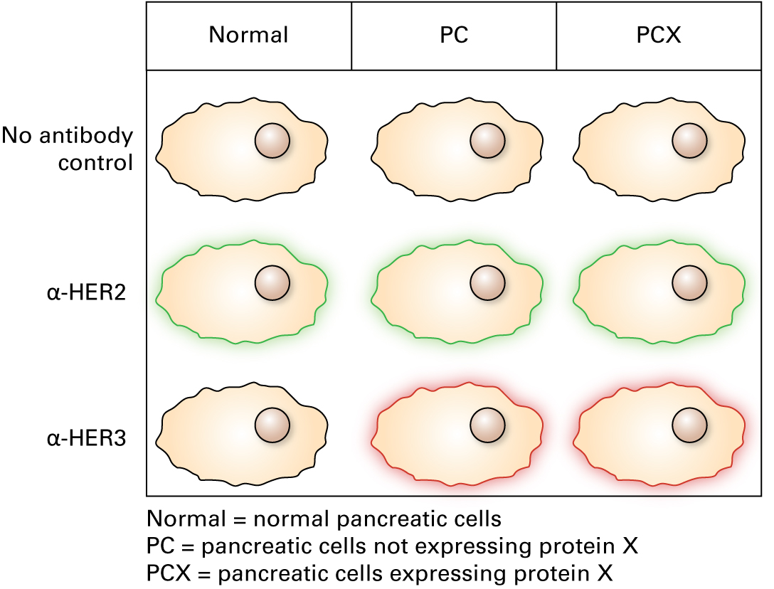 Immunofluorescence using fluorescein-conjugated antibodies for HER2 shows the following: Normal pancreatic cells: green fluorescence around the perimeter of the cell Pancreatic cells not expressing protein X: green fluorescence around the perimeter of the cell Pancreatic cells expressing protein X: green fluorescence around the perimeter of the cell Immunofluorescence using rhodamine-conjugated antibodies for HER3 shows the following: Normal pancreatic cells: no fluorescence Pancreatic cells not expressing protein X: red fluorescence around the perimeter of the cell Pancreatic cells expressing protein X: red fluorescence around the perimeter of the cell 