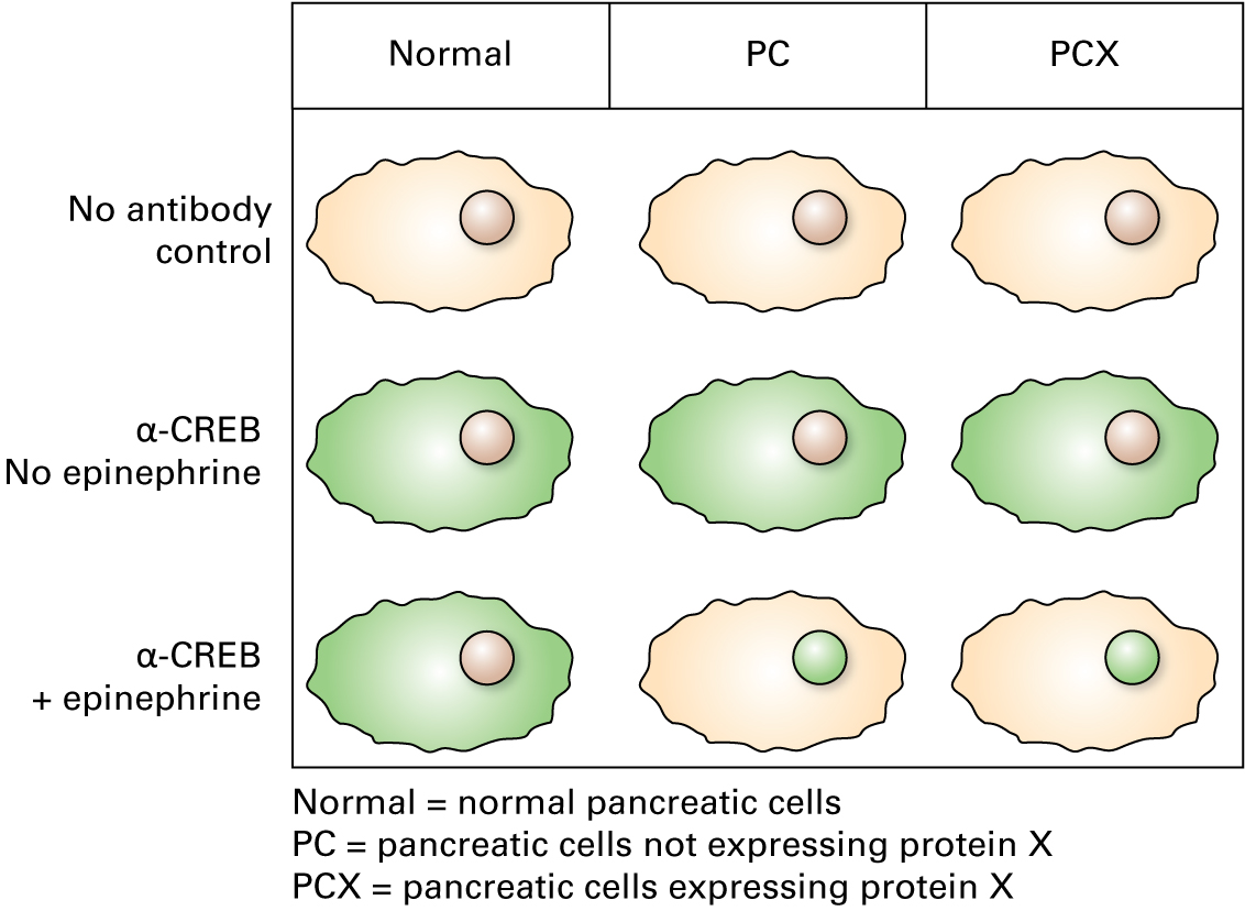 Immunofluorescence using fluorescein-conjugated antibodies for CREB shows the following: Normal pancreatic cells in the absence of epinephrine: green fluorescence in the cytosol of the cell Pancreatic cells not expressing protein X in the absence of epinephrine: green fluorescence in the cytosol of the cell Pancreatic cells expressing protein X in the absence of epinephrine: green fluorescence in the cytosol of the cell Normal pancreatic cells in the presence of epinephrine: green fluorescence in the cytosol of the cell Pancreatic cells not expressing protein X in the presence of epinephrine: green fluorescence in the nucleus of the cell Pancreatic cells expressing protein X in the presence of epinephrine: green fluorescence in the nucleus of the cell 