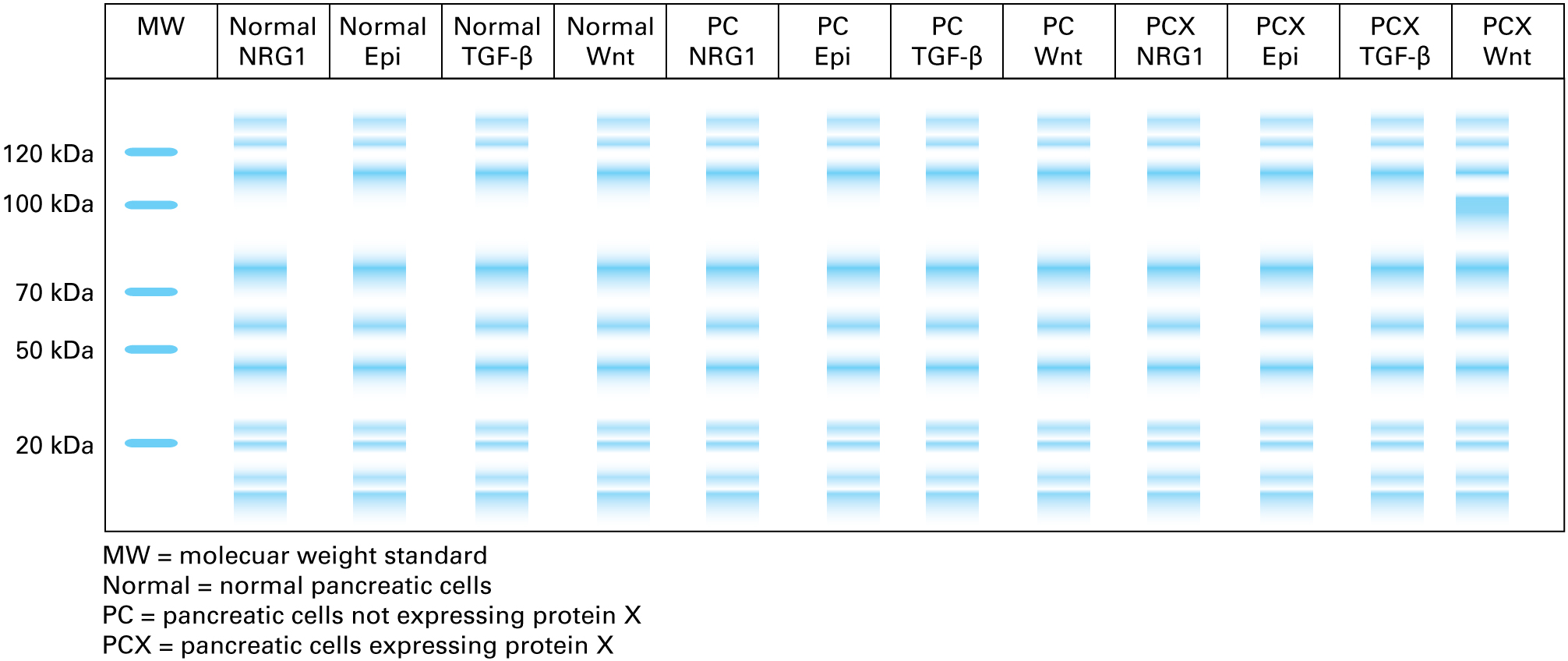 Coomassie staining of protein extracts from cells treated with the following ligands showed: Normal pancreatic cells in the presence of NRG1: standard smear pattern Normal pancreatic cells in the presence of epinephrine: standard smear pattern Normal pancreatic cells in the presence of TGF-β: standard smear pattern Normal pancreatic cells in the presence of Wnt: standard smear pattern Pancreatic cells not expressing protein X  in the presence of NRG1: standard smear pattern Pancreatic cells not expressing protein X  in the presence of epinephrine: standard smear pattern Pancreatic cells not expressing protein X  in the presence of TGF-β: standard smear pattern Pancreatic cells not expressing protein X  in the presence of Wnt: standard smear pattern Pancreatic cells expressing protein X  in the presence of NRG1: standard smear pattern Pancreatic cells expressing protein X  in the presence of epinephrine: standard smear pattern Pancreatic cells expressing protein X  in the presence of TGF-β: standard smear pattern Pancreatic cells expressing protein X  in the presence of Wnt: standard smear pattern with an extra band approximately 90 kDa  